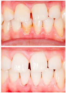 Periodontologia i lekarz periodontolog w Żyrardowie